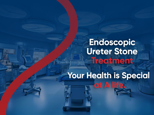 Endoscopic Ureteral Stone Removal: Flexible Laser